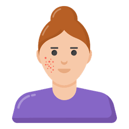 People Facing Acne | Pigmentation | Dull Skin